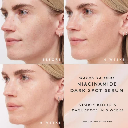 Fenty Skin Watch Ya Tone 5% Niacinamide Dark Spot Serum with Vitamin C - Imagen 8