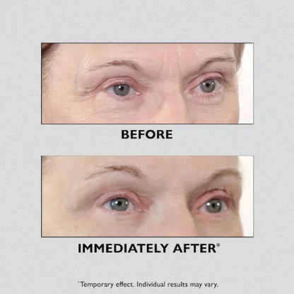 Peter Thomas Roth  Instant FIRMx® Eye Temporary Eye Tightener 1 onza - Imagen 5