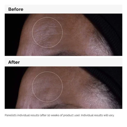 The Ordinary  GF 15% Serum for Visible Skin Repair and Wrinkles 30ml - Imagen 7