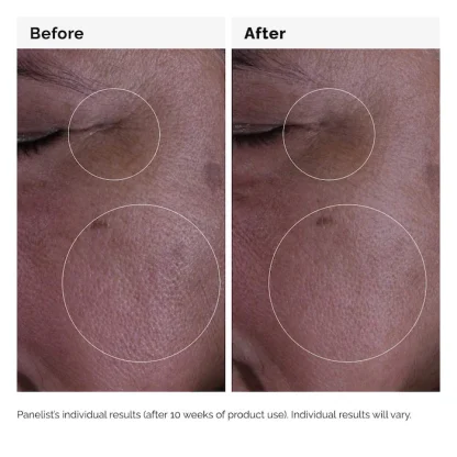 The Ordinary  GF 15% Serum for Visible Skin Repair and Wrinkles 30ml - Imagen 5