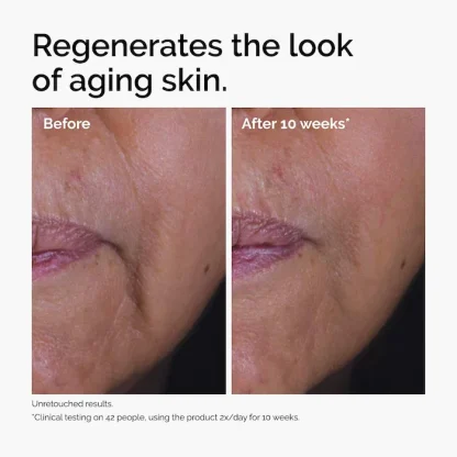 The Ordinary  GF 15% Serum for Visible Skin Repair and Wrinkles 30ml - Imagen 4
