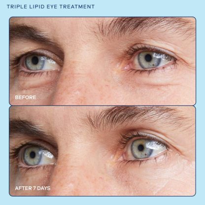 Skinfix  barrier+ Triple Lipid Brightening Eye Cream 15ML - Imagen 5