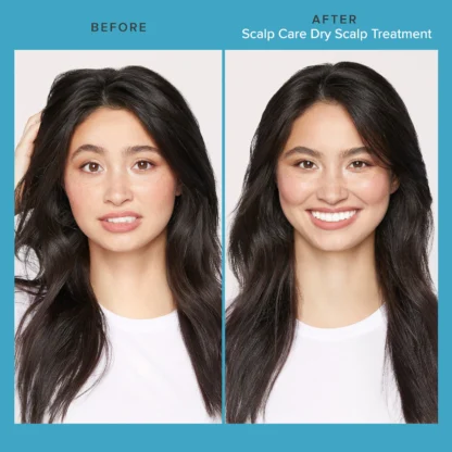 Living Proof  Scalp Care Dry Scalp Treatment - Imagen 7