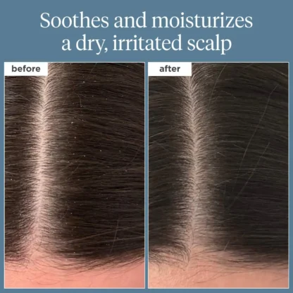 BRIOGEO HAIR CARE Scalp Revival™ Rosemary Pre-Wash Oil - Imagen 10